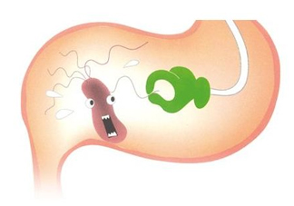 幽門螺桿菌會傳染嗎？幽門螺桿菌吃什么藥