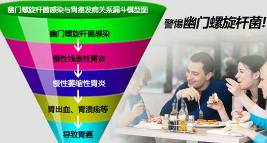 幽門螺桿菌的癥狀有哪些表現(xiàn)？幽門螺旋菌怎么治療