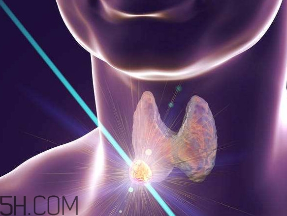 什么樣的甲狀腺結節(jié)要懷疑是癌？甲狀腺結節(jié)嚴重嗎