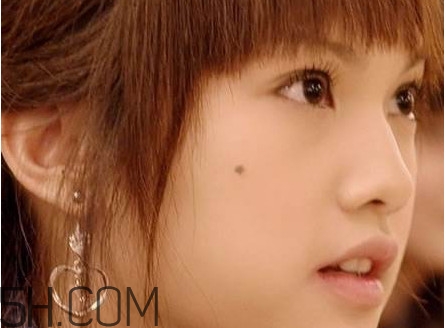 痣是怎么形成的？女人痣長哪里最有福氣