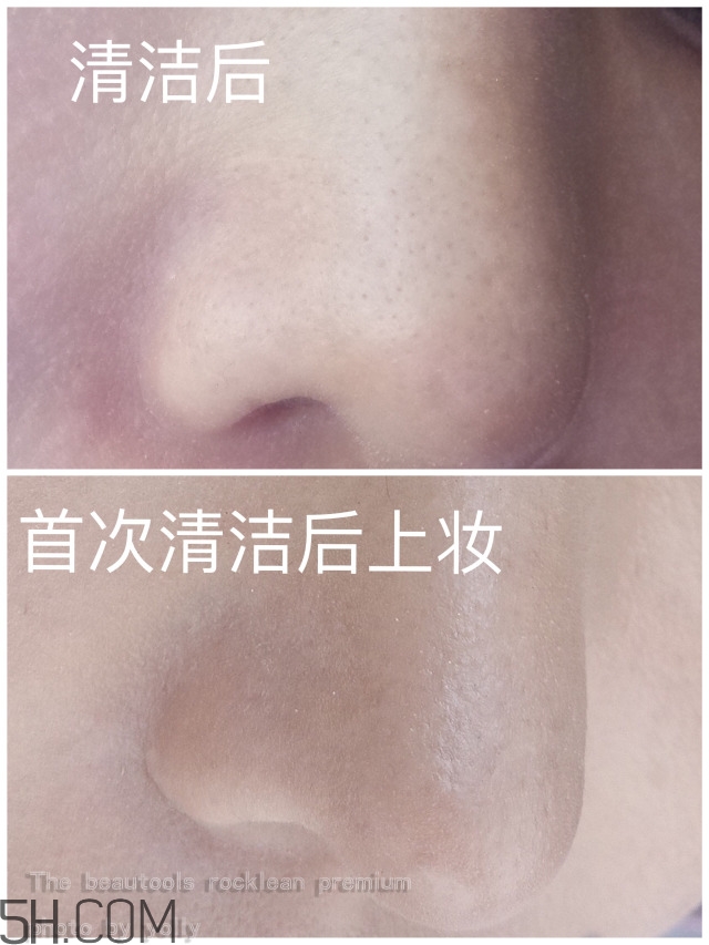 the beautools毛孔清潔器好用嗎_24k黑頭鏟評(píng)測(cè)