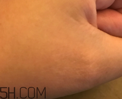 芳丹薄羅眼膜怎么用？芳丹薄羅眼膜要洗嗎