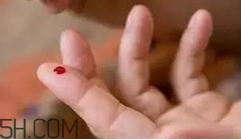 放血療法適合任何人嗎？放血療法是如何退出歷史舞臺(tái)的