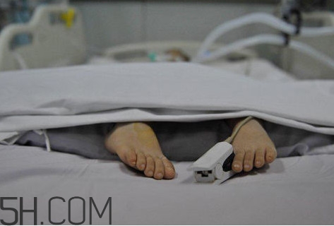 腦死亡是什么意思？腦死亡判定有嚴(yán)格標(biāo)準(zhǔn)