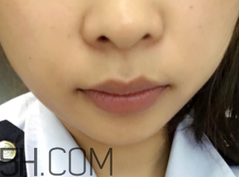 小蜜蜂細(xì)致修護(hù)唇膏很油嗎？夏天用合適嗎？