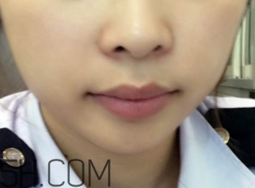 小蜜蜂細(xì)致修護(hù)唇膏很油嗎？夏天用合適嗎？