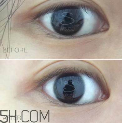 viicode眼膜有用嗎？viicode眼膜評測