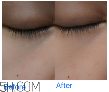 小蜜蜂水洗面膜怎么樣？小蜜蜂水洗面膜好用嗎？