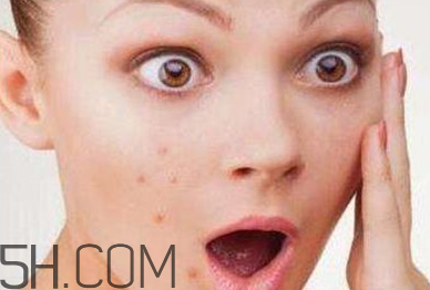 卸妝油適合痘痘肌膚嗎？植村秀卸妝油哪款最好用？