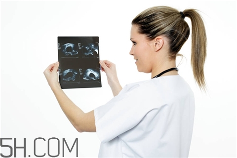 骨折會影響月經(jīng)嗎？骨折對性功能有影響嗎？