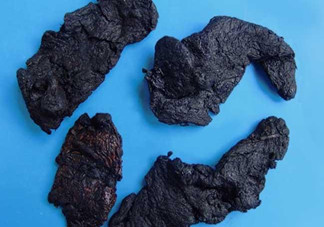 熟地黃是什么？熟地黃有什么功效？