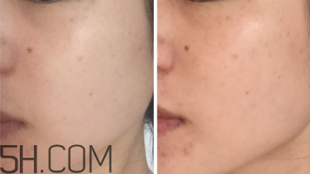 科顏氏淡斑精華液有用嗎？科顏氏淡斑精華液使用心得