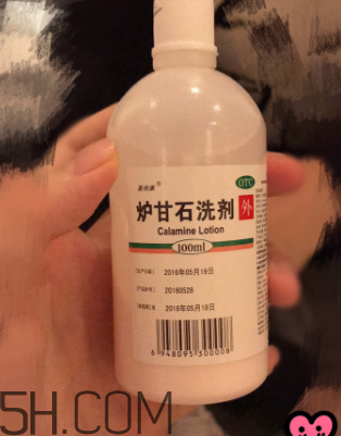 爐甘石洗劑是洗還是擦？爐甘石洗劑是什么顏色？