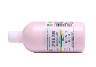 爐甘石洗劑能治痘痘嗎？爐甘石洗劑能治皰疹嗎？