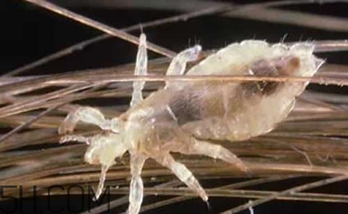 孩子長虱子是怎么回事？孩子長虱子該怎么辦？