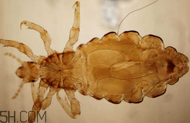 孩子長虱子是怎么回事？孩子長虱子該怎么辦？