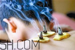艾灸對(duì)慢性咽炎有用嗎？慢性咽炎可以通過(guò)艾灸來(lái)治療嗎？