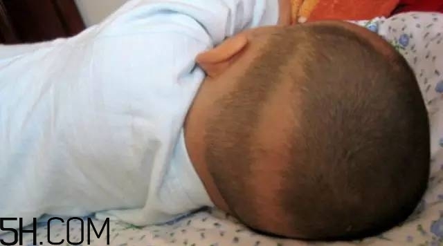 寶寶枕禿怎么辦？如何改善寶寶枕禿現(xiàn)象？