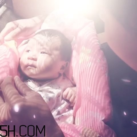 寶寶枕禿怎么辦？如何改善寶寶枕禿現(xiàn)象？