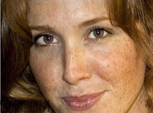 血瘀體質(zhì)容易長色斑嗎？有血瘀體質(zhì)的人如何去除色斑呢？