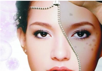 血瘀體質(zhì)容易長色斑嗎？有血瘀體質(zhì)的人如何去除色斑呢？