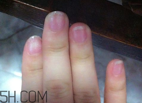 美甲后指甲受損怎么辦？指甲破損怎么修復(fù)？