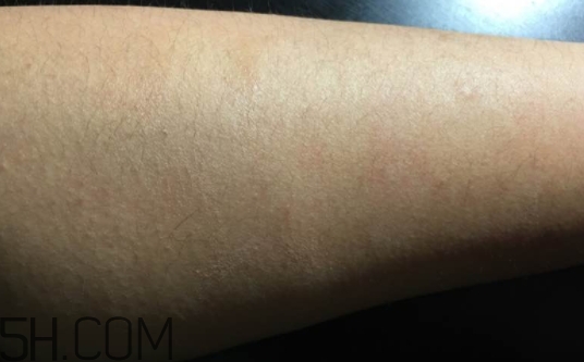 千纖草卸妝水有激素嗎？千纖草卸妝水曝光