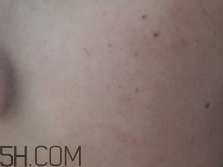 724高保濕面霜是什么？724高保濕面霜好用嗎？