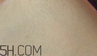 豬油膏要卸妝嗎？豬油膏怎么卸妝？