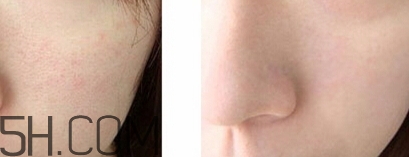 豬油膏要卸妝嗎？豬油膏怎么卸妝？