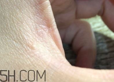 雅頓金膠適合什么膚質(zhì)？雅頓金膠適合油皮和混油皮嗎？