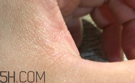 雅頓金膠適合什么膚質(zhì)？雅頓金膠適合油皮和混油皮嗎？