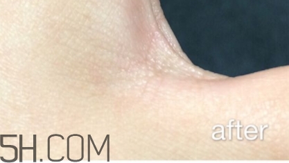 雅頓小銀蛋是什么？雅頓小銀蛋多少錢(qián)？