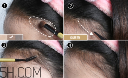 發(fā)際線不好看怎么修飾 完美解決6種發(fā)際線問題 發(fā)際線不好看怎么修飾 完美解決6種發(fā)際線問題