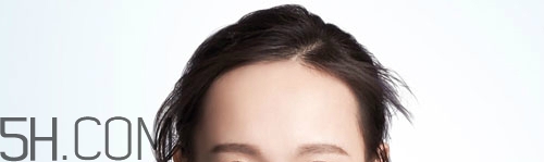 發(fā)際線不好看怎么修飾 完美解決6種發(fā)際線問題 發(fā)際線不好看怎么修飾 完美解決6種發(fā)際線問題