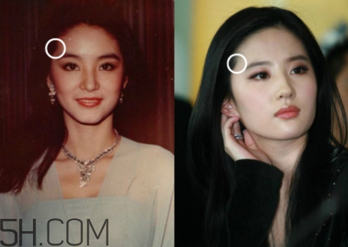 發(fā)際線不好看怎么修飾 完美解決6種發(fā)際線問題 發(fā)際線不好看怎么修飾 完美解決6種發(fā)際線問題