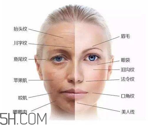 怎么預(yù)防皺紋的產(chǎn)生？導(dǎo)致皺紋的產(chǎn)生的原因有哪些？