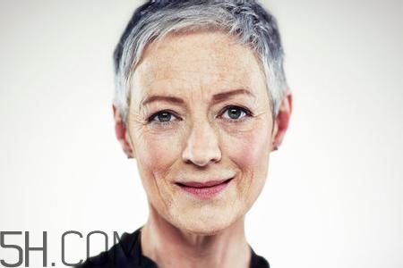 怎么預(yù)防皺紋的產(chǎn)生？導(dǎo)致皺紋的產(chǎn)生的原因有哪些？