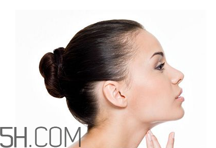 適合打瘦臉針的人群有哪些？瘦臉針注射后注意事項