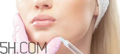 嬰兒肥能打瘦臉針嗎？瘦臉針打幾次可以定型？