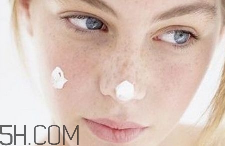 常見的色斑有哪些？常見的色斑有哪些種類？