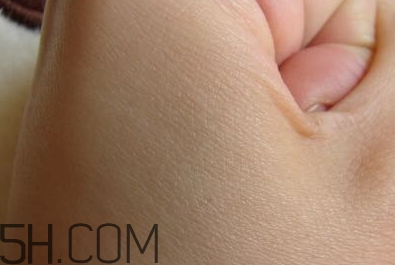 雅頓眼膠怎么用？雅頓眼膠使用方法