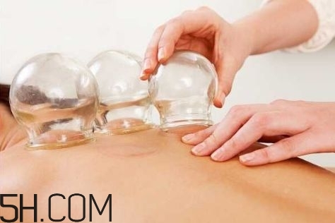 拔罐可以治療鼻炎嗎？鼻炎拔罐拔哪里？