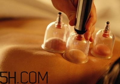 拔罐可以治療鼻炎嗎？鼻炎拔罐拔哪里？