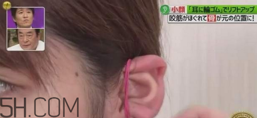 打瘦臉針的前后注意事項 臉胖的原因有哪些 打瘦臉針的前后注意事項 臉胖的原因有哪些