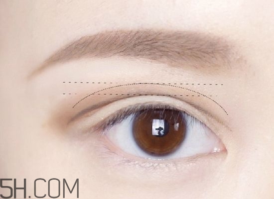 割完雙眼皮不能吃什么？割完雙眼皮如何進(jìn)行飲食調(diào)理？