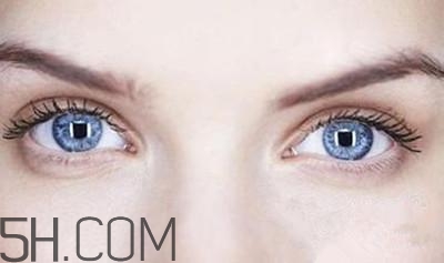 割完雙眼皮不能吃什么？割完雙眼皮如何進(jìn)行飲食調(diào)理？