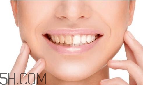 羨慕別人的大白牙？為什么你的牙齒這么黃？