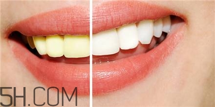 羨慕別人的大白牙？為什么你的牙齒這么黃？