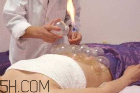 腹部拔罐可以減肥嗎？腹部拔罐拔哪個位置？